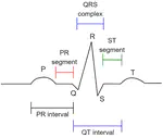 Evaluation of electrocardiogram: numerical vs. image data for emotion recognition system